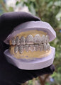 Moissanite Grillz